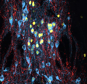 [Архэ] Сергей Лопатин ― Биология стресса. Лекция 3: Хронический стресс (2024)