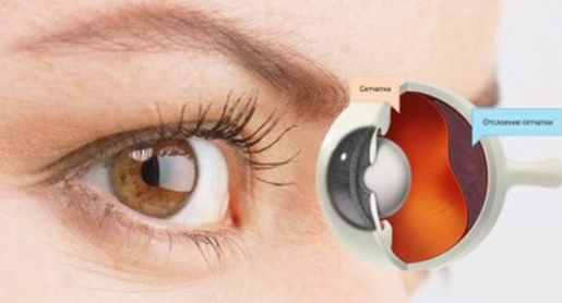 [Людмила Лазарева] Восстановление сетчатки (2023)